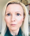 Ditte Demontis og kolleger har analyseret mere end otte mio. genetiske varianter hos hver person for at identificere varianter, der er overrepræsenteret hos personer med ADHD med adfærdsforstyrrelser sammenlignet med personer, som ikke har sygdommene. F